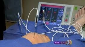 دکتر حسین ارجمند, متخصص درد, ساییدگی شدید زانو,Radiofrequency neurotomy, genicular nerve ablation دکتر حسین ارجمند, متخصص درد, ساییدگی شدید زانو,Radiofrequency neurotomy, genicular nerve ablation
